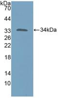 Polyclonal Antibody to Katanin P60 Subunit A 1 (KATNA1)
