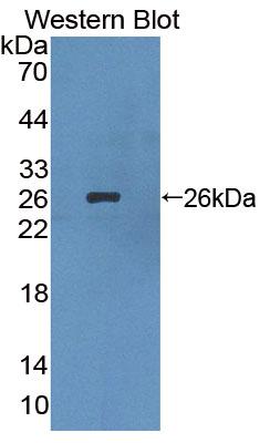 Polyclonal Antibody to Lens Intrinsic Membrane Protein 2 (LIM2)