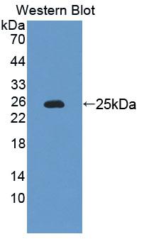 Polyclonal Antibody to Leucine Rich Repeats And Death Domain Containing Protein (LRDD)