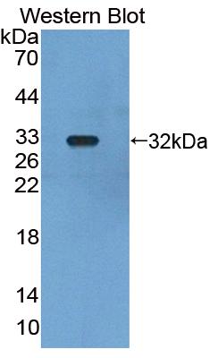 Polyclonal Antibody to Leucine Rich Repeats And Death Domain Containing Protein (LRDD)
