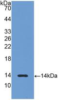 Polyclonal Antibody to Luteinizing Hormone Beta Polypeptide (LHb)