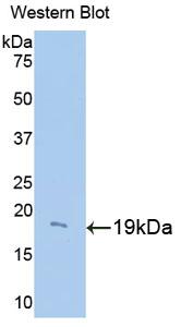 Polyclonal Antibody to Mitochondrial Uncoupling Protein 2 (UCP2)