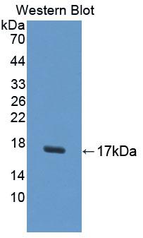Polyclonal Antibody to Uroplakin 1A (UPK1A)