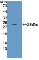 Polyclonal Antibody to Xanthine Dehydrogenase (XDH)