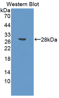 Polyclonal Antibody to Midline 1 (MID1)