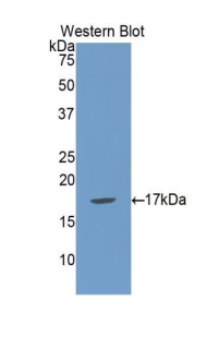 Polyclonal Antibody to Microseminoprotein Beta (MSMb)