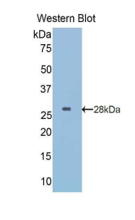 Polyclonal Antibody to Insulin Like Growth Factor Binding Protein 5 (IGFBP5)