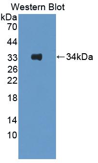 Polyclonal Antibody to Oxysterol Binding Protein (OSBP)