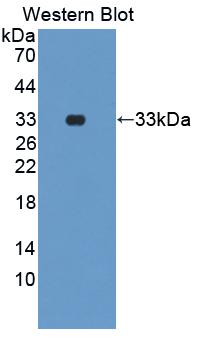 Polyclonal Antibody to Peptidyl Arginine Deiminase Type I (PADI1)