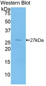 Polyclonal Antibody to Pyruvate Dehydrogenase Kinase Isozyme 1 (PDK1)