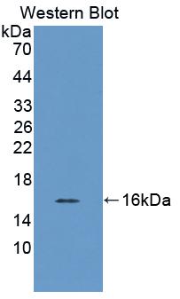 Polyclonal Antibody to Sterol Carrier Protein 2 (SCP2)
