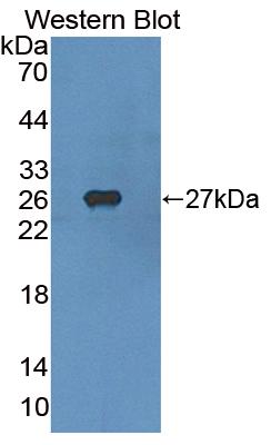 Polyclonal Antibody to Sterol Regulatory Element Binding Transcription Factor 1 (SREBF1)