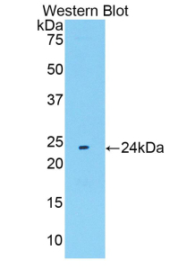 Polyclonal Antibody to Fibroblast Growth Factor 13 (FGF13)