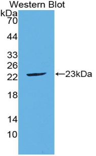 Polyclonal Antibody to Fibroblast Growth Factor 21 (FGF21)