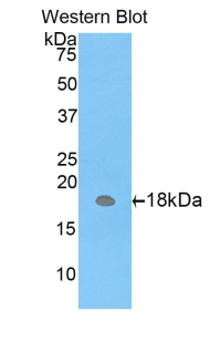 Polyclonal Antibody to Carcinoembryonic Antigen Related Cell Adhesion Molecule 3 (CEACAM3)