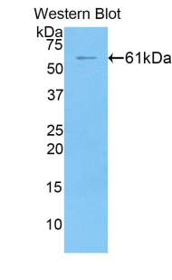 Polyclonal Antibody to Fibrinogen Like Protein 1 (FGL1)