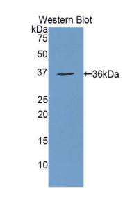Polyclonal Antibody to Carbonic Anhydrase XII (CA12)