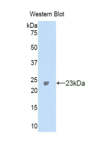 Polyclonal Antibody to Carbonic Anhydrase VA (CA5A)