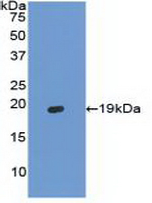 Polyclonal Antibody to Hemoglobin Alpha 1 (HBa1)
