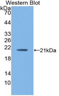 Polyclonal Antibody to Hemoglobin Alpha 1 (HBa1)
