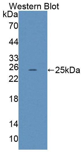 Polyclonal Antibody to Low Density Lipoprotein Receptor Related Protein 2 (LRP2)