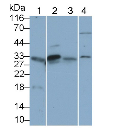 Polyclonal Antibody to Kallikrein 2 (KLK2)