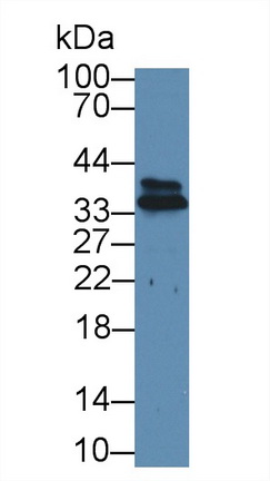 Polyclonal Antibody to Ribonuclease H2 Subunit A (RNASEH2A)