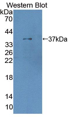 Polyclonal Antibody to 5'-3'Exoribonuclease 1 (XRN1)