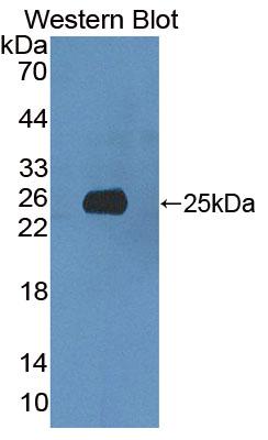 Polyclonal Antibody to 5'-3'Exoribonuclease 1 (XRN1)