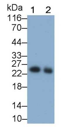 Polyclonal Antibody to Troponin I Type 2, Fast Skeletal (TNNI2)