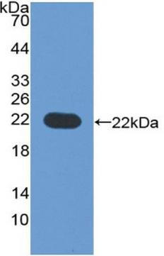 Polyclonal Antibody to Cytochrome P450 3A4 (CYP3A4)