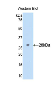 Polyclonal Antibody to Cytochrome P450 2D6 (CYP2D6)