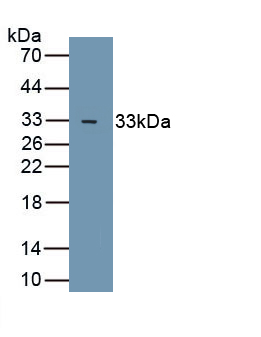 Polyclonal Antibody to Glycogen Synthase Kinase 3 Beta (GSK3b)