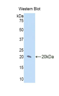 Polyclonal Antibody to Interleukin 17 Receptor D (IL17RD)