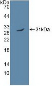 Polyclonal Antibody to Protein Kinase, AMP Activated Alpha 2 (PRKAa2)