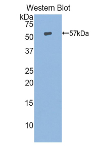 Polyclonal Antibody to Heat Shock 70kDa Protein 14 (HSPA14)