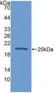 Polyclonal Antibody to Apolipoprotein L2 (APOL2)