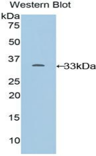 Polyclonal Antibody to Cytochrome P450 24A1 (CYP24A1)