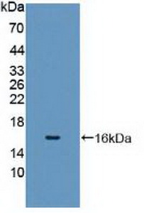 Polyclonal Antibody to Cytochrome P450 11A1 (CYP11A1)