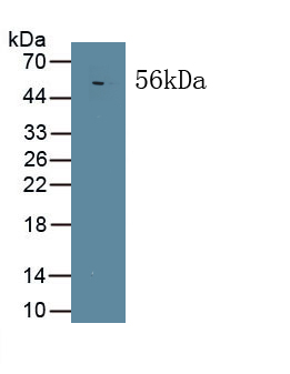 Polyclonal Antibody to Mitogen Activated Protein Kinase Associated Protein 1 (MAPKAP1)