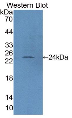 Polyclonal Antibody to Protein Tyrosine Phosphatase Receptor Type N2 (PTPRN2)