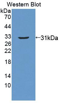 Polyclonal Antibody to ATP Binding Cassette Transporter C11 (ABCC11)