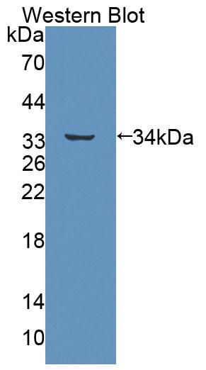 Polyclonal Antibody to ATP Binding Cassette Transporter B7 (ABCB7)