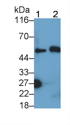 Polyclonal Antibody to Kynureninase (KYNU)