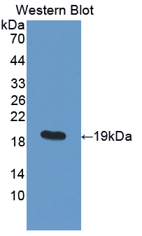 Polyclonal Antibody to Protein Disulfide Isomerase A5 (PDIA5)