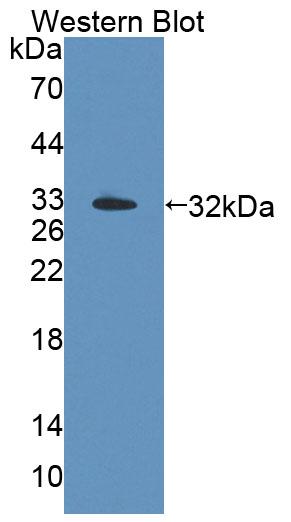 Polyclonal Antibody to Topoisomerase III Beta (TOP3b)