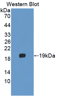 Polyclonal Antibody to Phospholipase A2, Group X (PLA2G10)