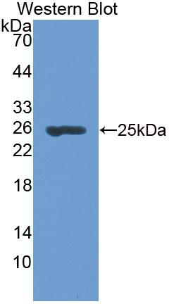 Polyclonal Antibody to Branched Chain Aminotransferase 2, Mitochondrial (BCAT2)