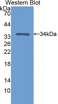 Polyclonal Antibody to 5'-Nucleotidase, Cytosolic III (NT5C3)