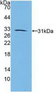 Polyclonal Antibody to Retinoic Acid Receptor Beta (RARb)